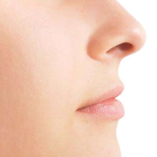 Quien se puede hacer una operación de nariz, cuales son los candidatos ideales?. Cirugía y Operación de nariz.